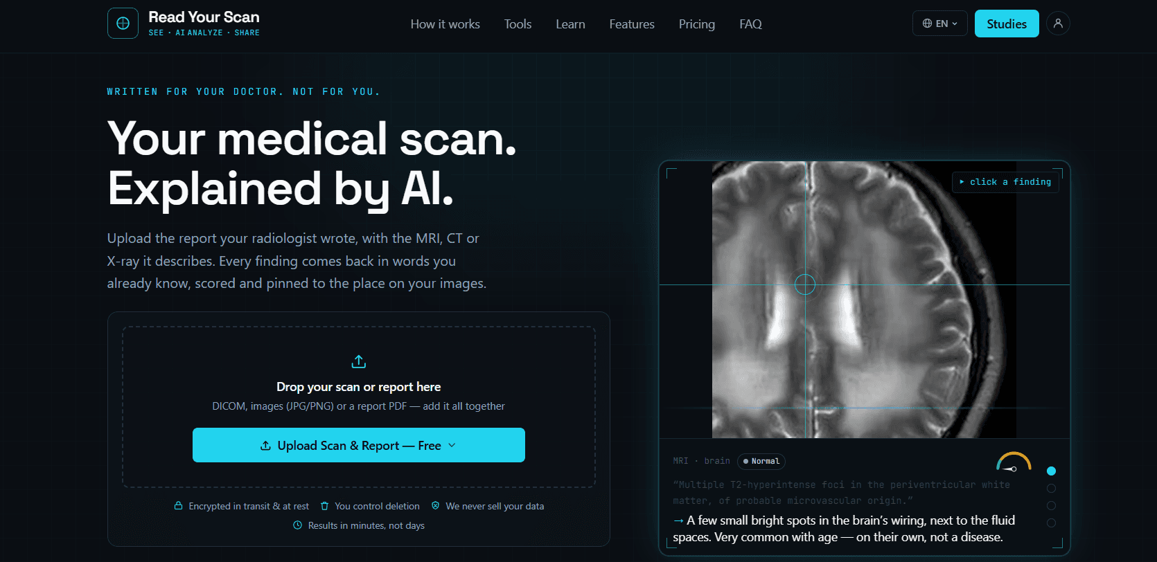 AI analyze your radiology Scan (MRI CT X-Ray) image 2