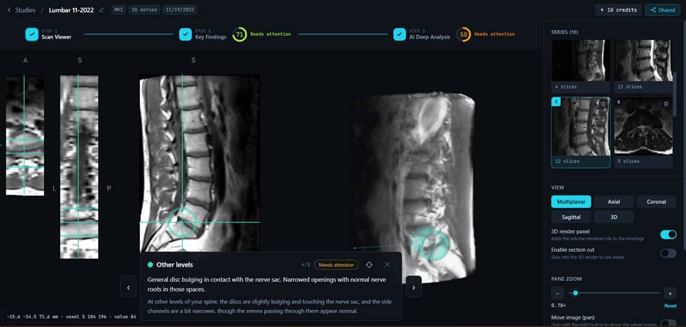 AI analyze your radiology Scan (MRI CT X-Ray) image 1
