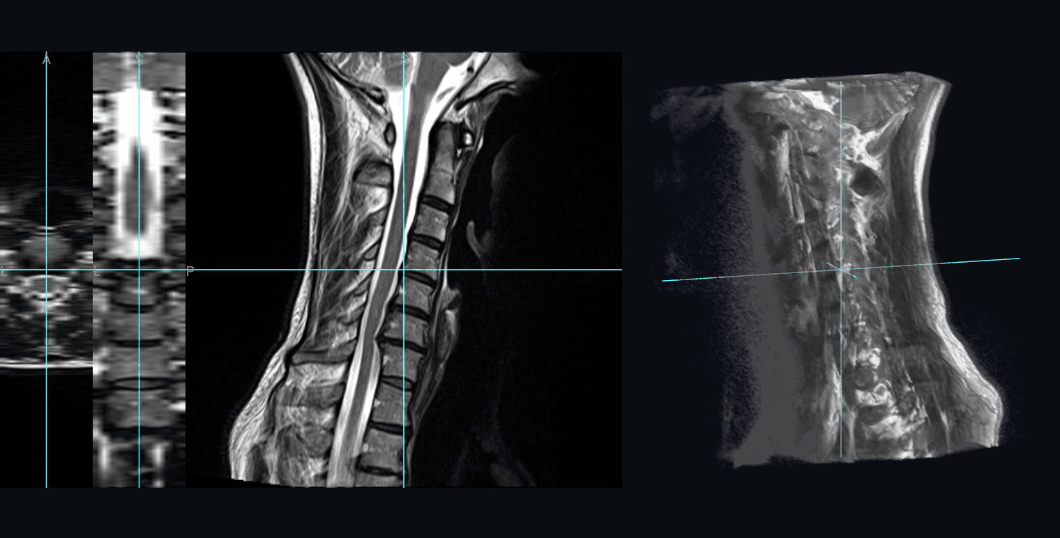 AI analyze your radiology Scan (MRI CT X-Ray) image 3