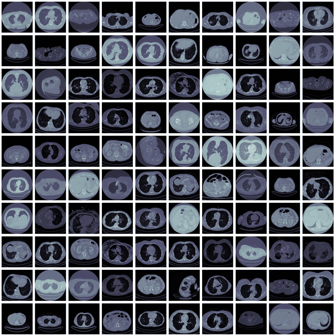 AI Radiology