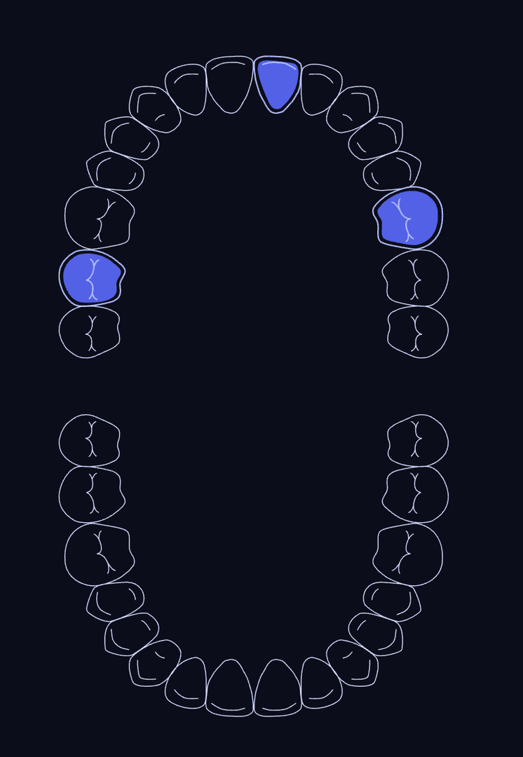 React Odontogram image 2