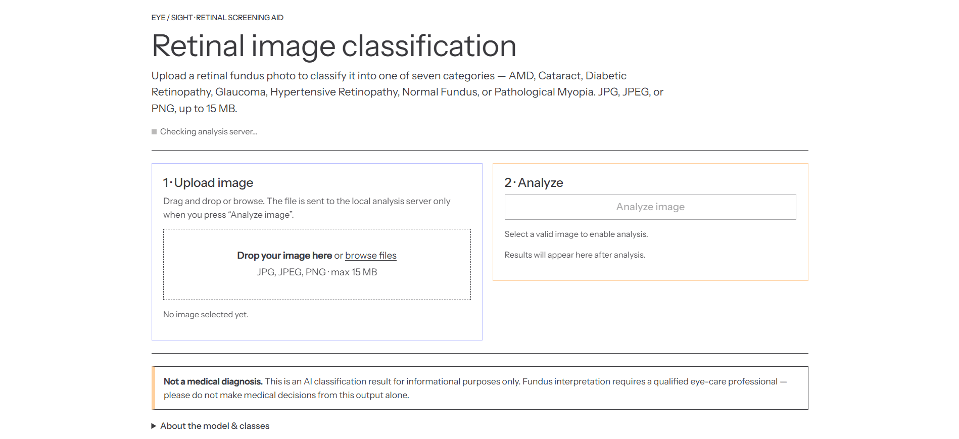 RetinaVision image 1