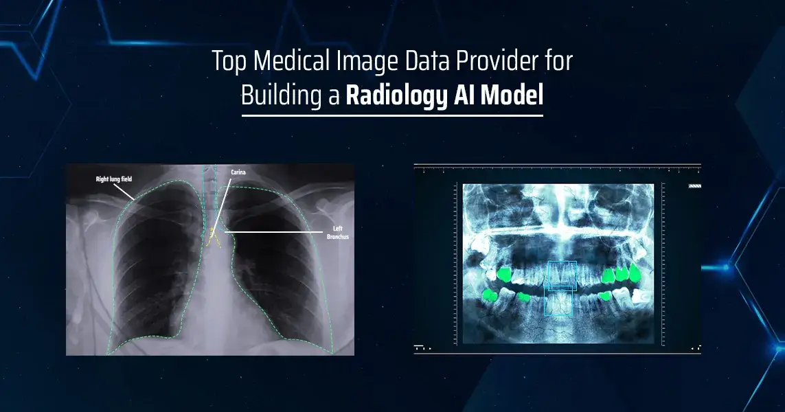 Top Medical Image data provider for building a Radiology AI model